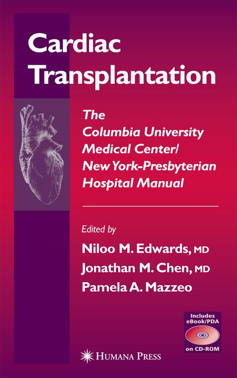 Produktbild: Cardiac Transplantation