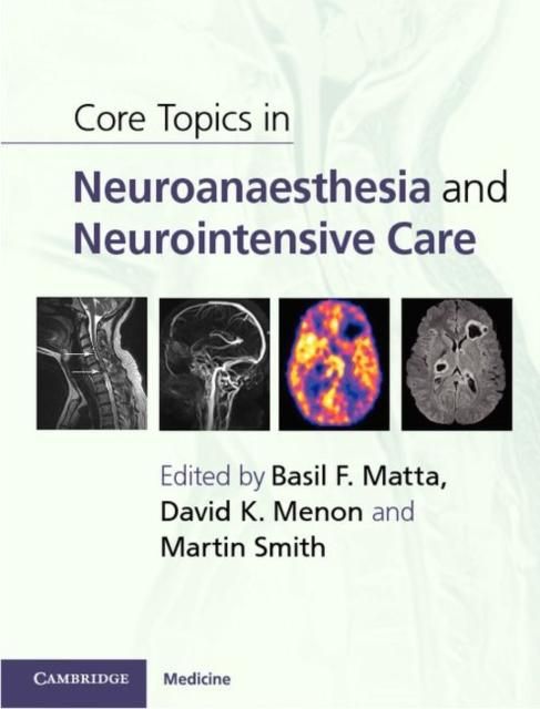 Produktbild: Core Topics in Neuroanaesthesia and Neurointensive Care