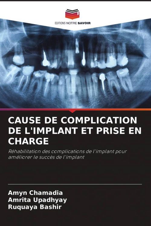 Produktbild: CAUSE DE COMPLICATION DE L'IMPLANT ET PRISE EN CHARGE