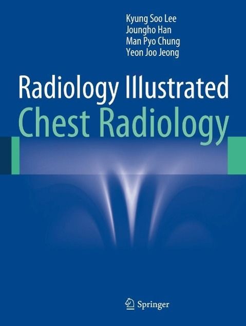 Produktbild: Radiology Illustrated: Chest Radiology