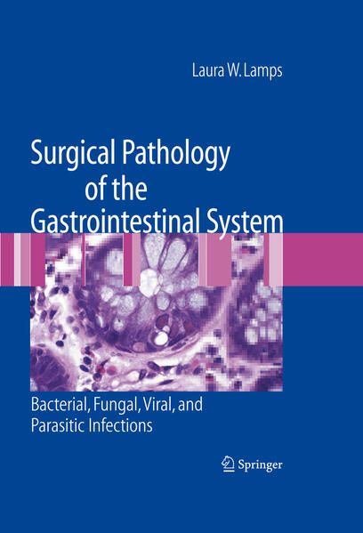 Produktbild: Surgical Pathology of the Gastrointestinal System: Bacterial, Fungal, Viral, and Parasitic Infections