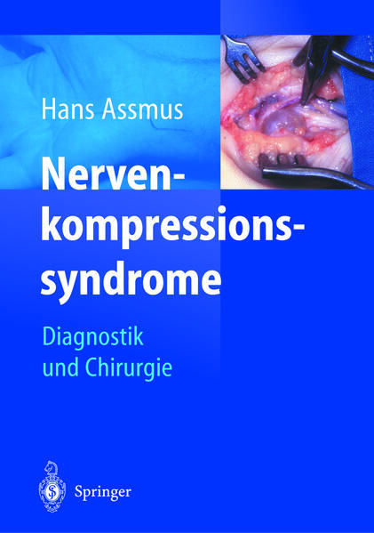 Produktbild: Nerven-kompressions-syndrome
