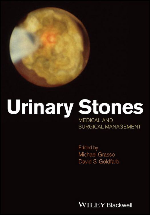 Produktbild: Urinary Stones