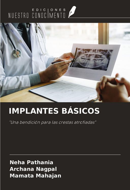 Produktbild: Implantes B&aacute;sicos