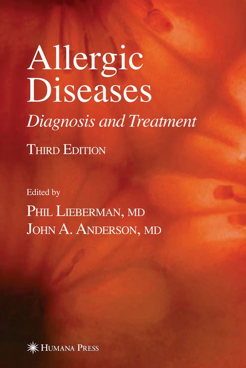 Produktbild: Allergic Diseases