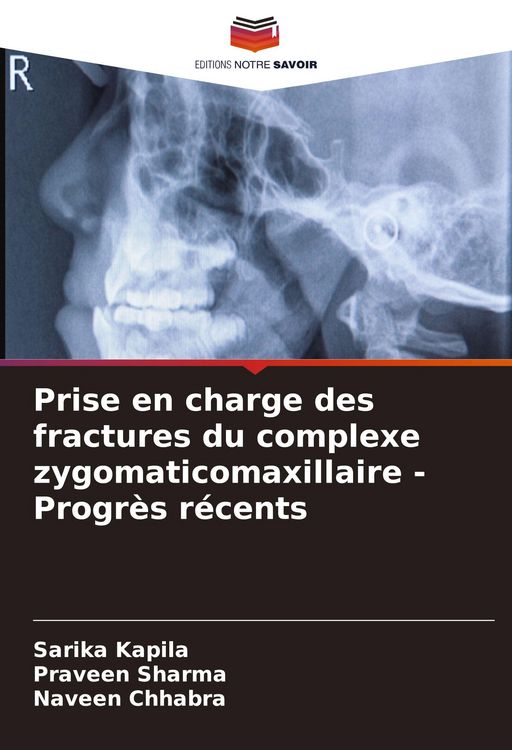 Produktbild: Prise en charge des fractures du complexe zygomaticomaxillaire - Progr&egrave;s r&eacute;cents