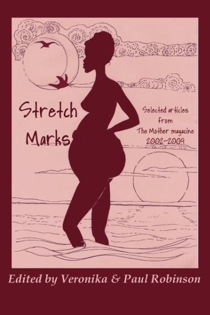 Produktbild: Stretch Marks