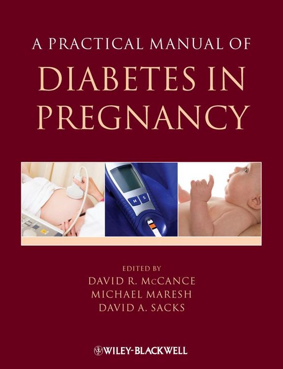 Produktbild: A Practical Manual of Diabetes in Pregnancy