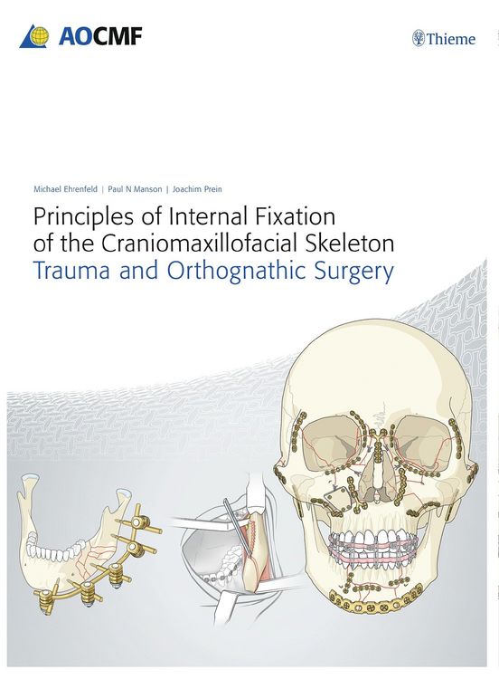 Produktbild: Principles of Internal Fixation of the Craniomaxillofacial Skeleton