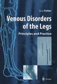 Produktbild: Venous Disorders of the Legs