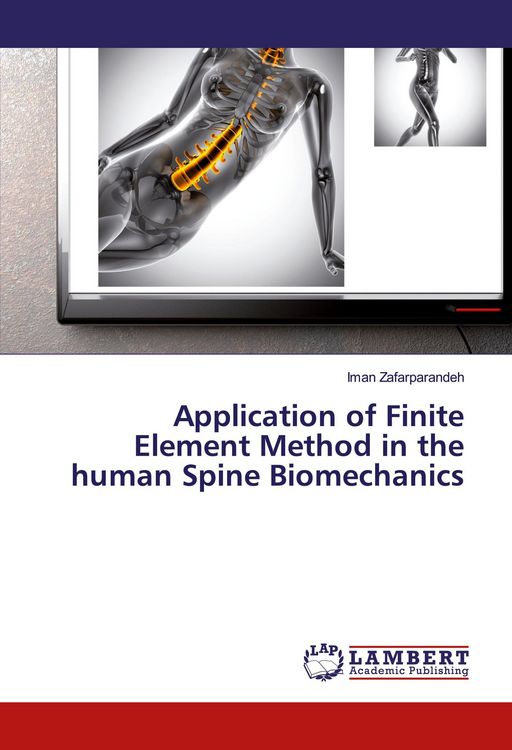 Produktbild: Application of Finite Element Method in the human Spine Biomechanics