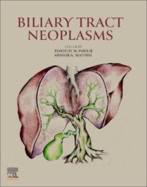 Produktbild: Biliary Tract Neoplasms