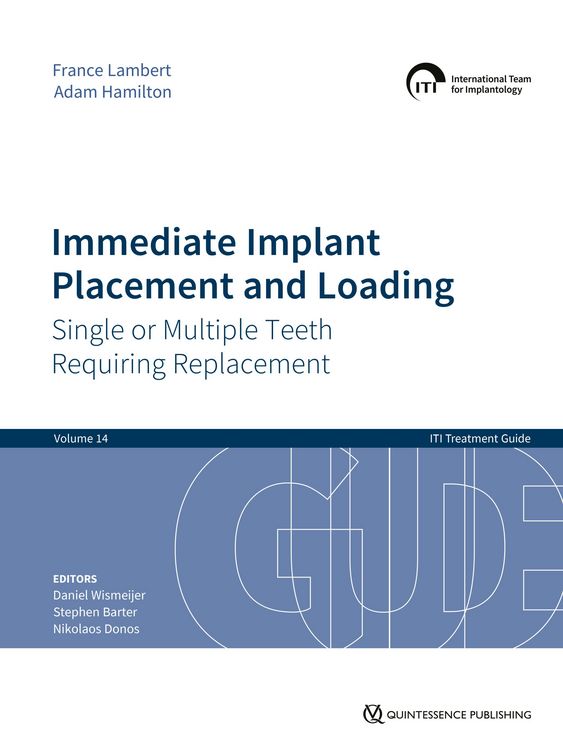 Produktbild: Immediate Implant Placement and Loading - Single or Multiple Teeth Requiring Replacement