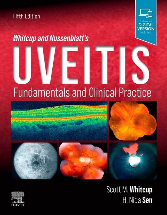 Produktbild: Whitcup and Nussenblatt's Uveitis