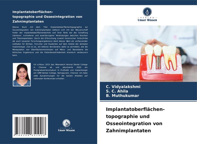 Produktbild: Implantatoberfl&auml;chen- topographie und Osseointegration von Zahnimplantaten
