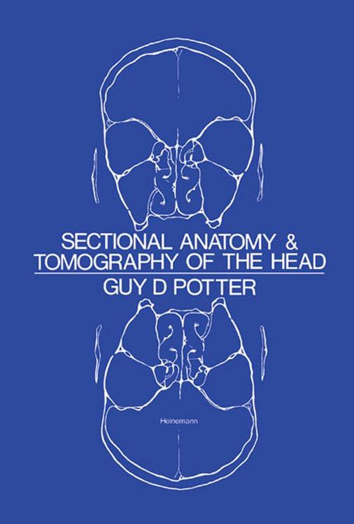 Produktbild: Sectional Anatomy and Tomography of the Head