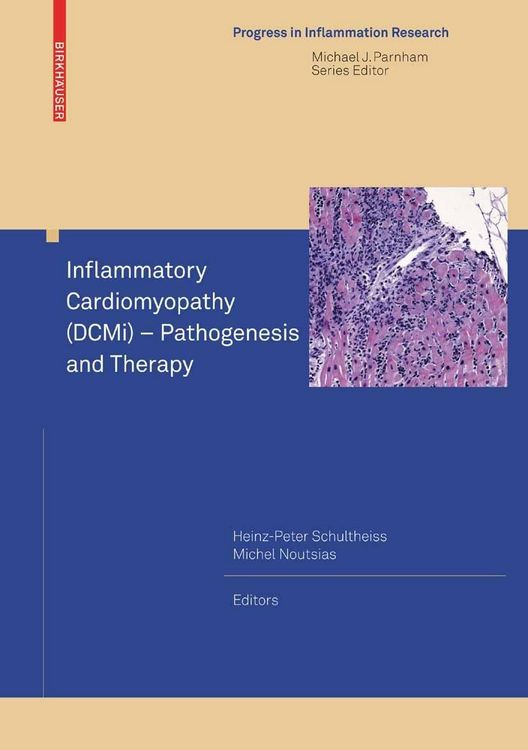 Produktbild: Inflammatory Cardiomyopathy (DCMi) - Pathogenesis and Therapy