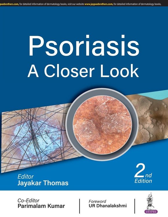 Produktbild: Psoriasis