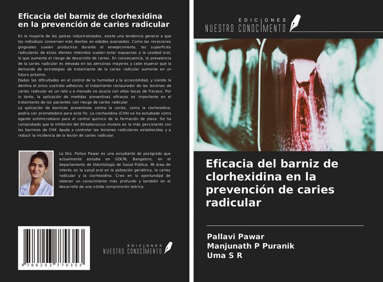 Produktbild: Eficacia del barniz de clorhexidina en la prevenci&oacute;n de caries radicular