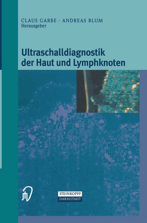 Produktbild: Ultraschalldiagnostik der Haut und Lymphknoten