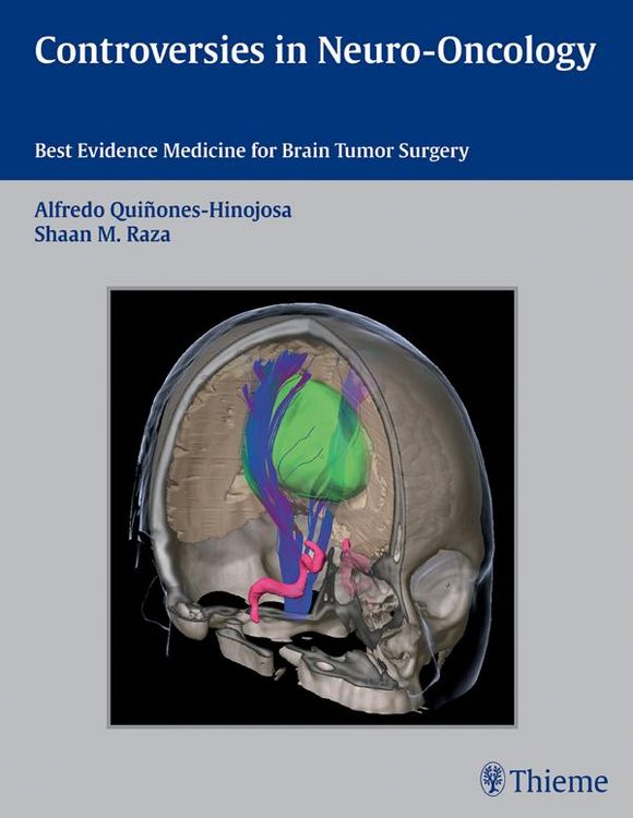 Produktbild: Controversies in Neuro-Oncology