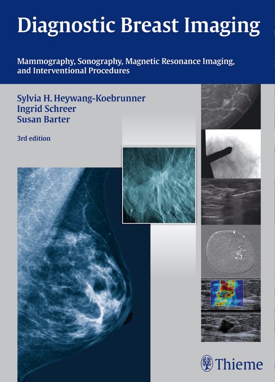 Produktbild: Diagnostic Breast Imaging