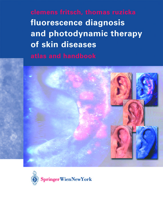 Produktbild: Fluorescence Diagnosis and Photodynamic Therapy of Skin Diseases