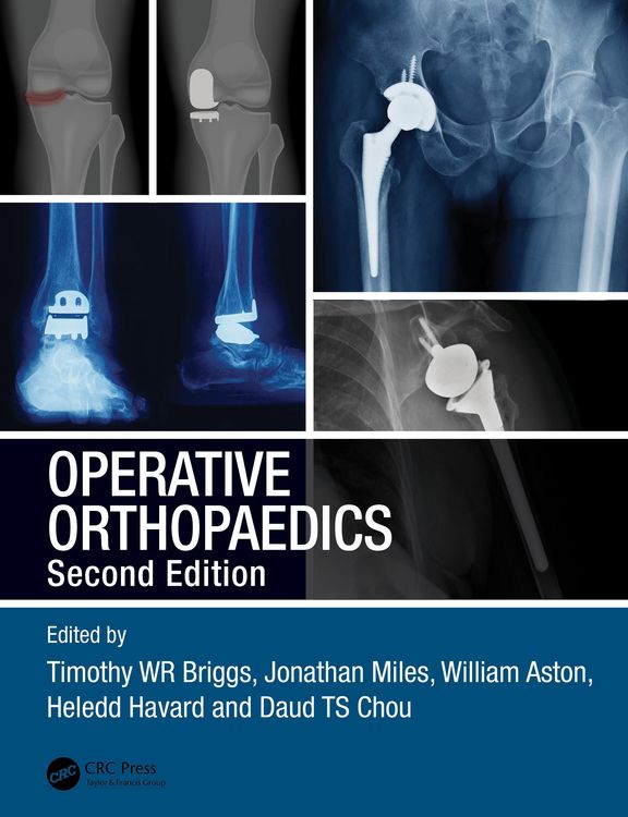 Produktbild: Operative Orthopaedics