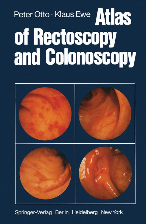 Produktbild: Atlas of Rectoscopy and Coloscopy
