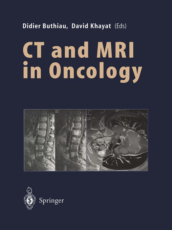 Produktbild: CT and MRI in Oncology