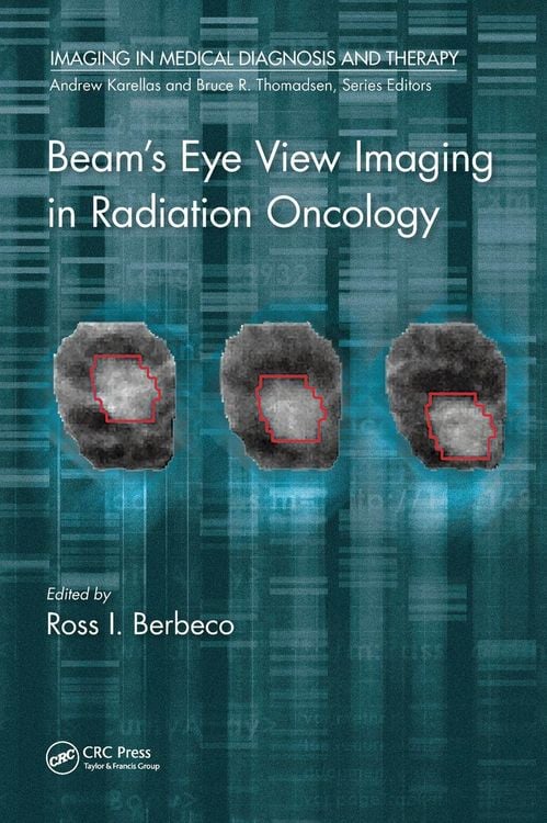 Produktbild: Beam's Eye View Imaging in Radiation Oncology