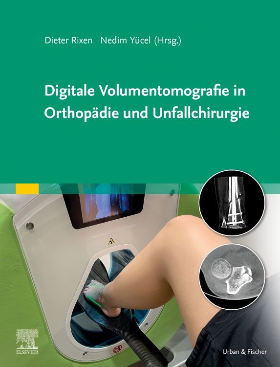 Produktbild: Digitale Volumentomografie in Orthop&auml;die und Unfallchirurgie
