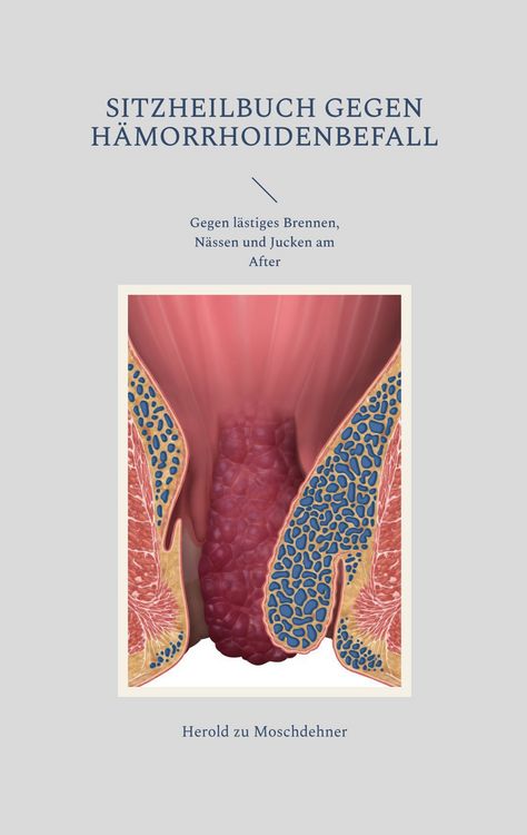 Produktbild: Sitzheilbuch gegen H&auml;morrhoidenbefall