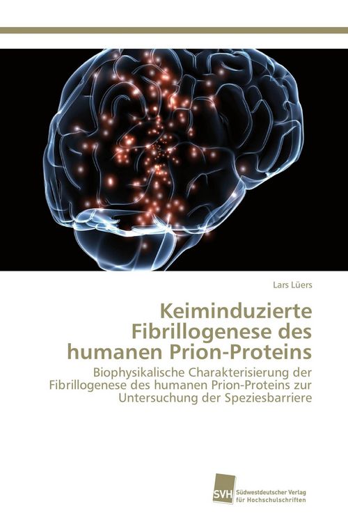 Produktbild: Keiminduzierte Fibrillogenese des humanen Prion-Proteins