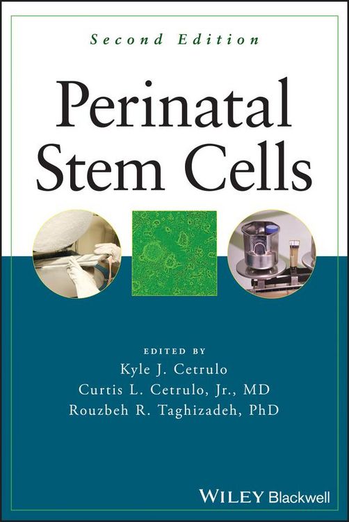 Produktbild: Perinatal Stem Cells