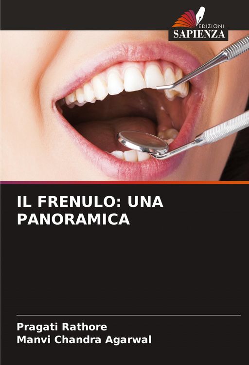 Produktbild: Il Frenulo: Una Panoramica