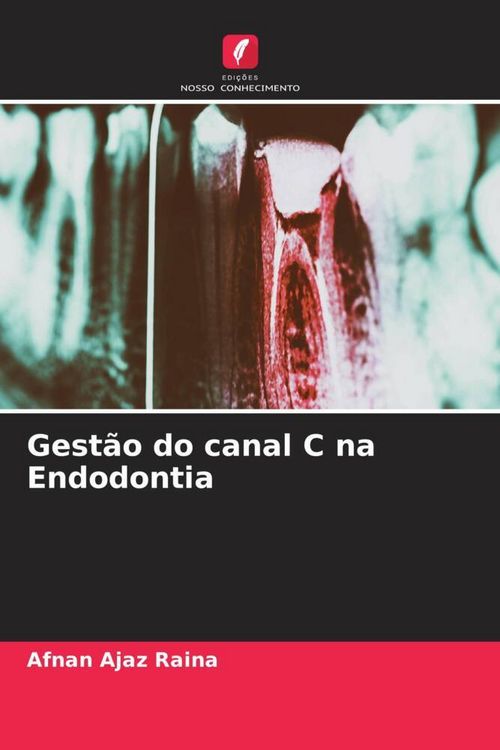 Produktbild: Gest&atilde;o do canal C na Endodontia
