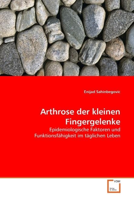 Produktbild: Sahinbegovic, E: Arthrose der kleinen Fingergelenke