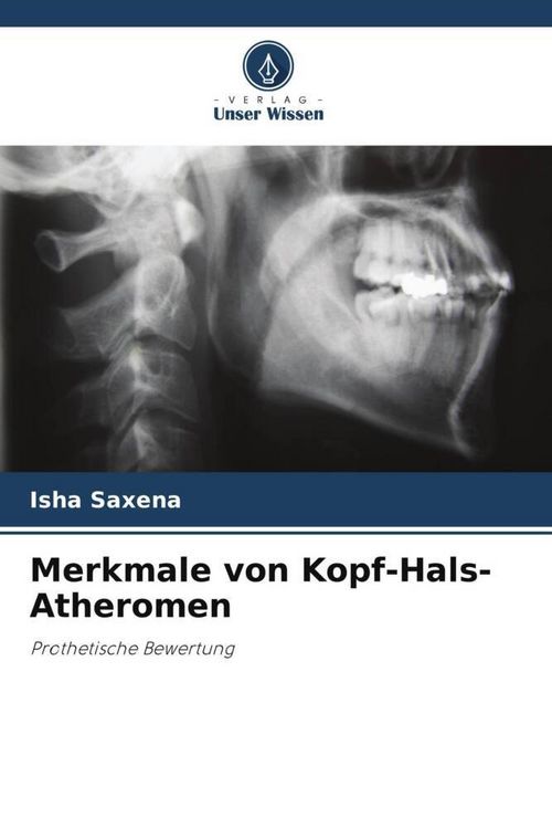 Produktbild: Merkmale von Kopf-Hals-Atheromen