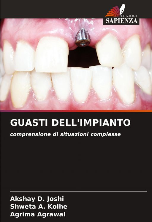 Produktbild: Guasti Dell'impianto