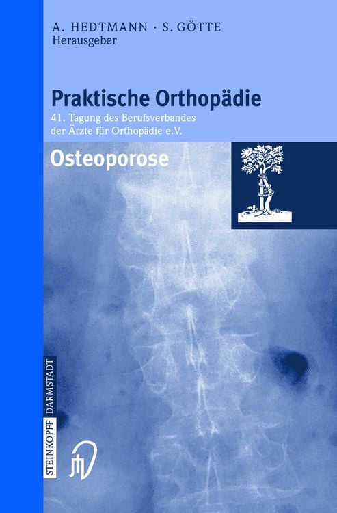 Produktbild: Osteoporose