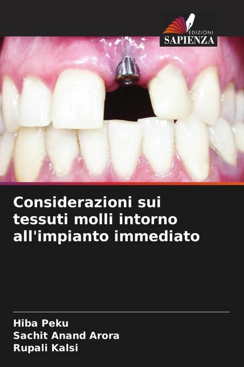 Produktbild: Considerazioni sui tessuti molli intorno all'impianto immediato