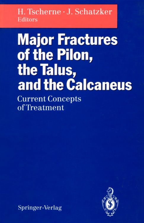 Produktbild: Major Fractures of the Pilon, the Talus, and the Calcaneus