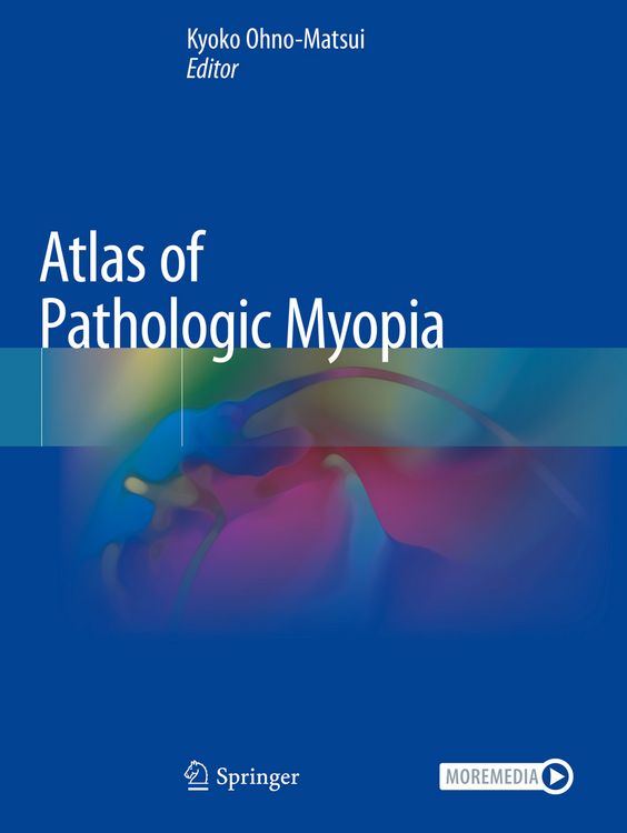 Produktbild: Atlas of Pathologic Myopia