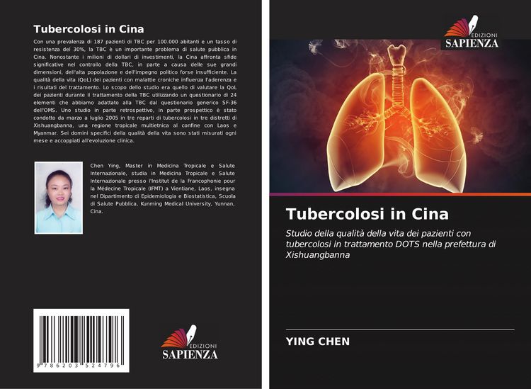 Produktbild: Tubercolosi in Cina