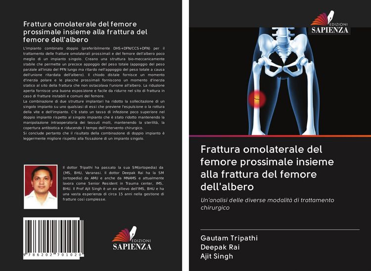 Produktbild: Frattura omolaterale del femore prossimale insieme alla frattura del femore dell'albero
