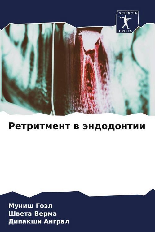 Produktbild: Retritment w &auml;ndodontii