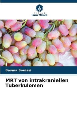 Produktbild: MRT von intrakraniellen Tuberkulomen
