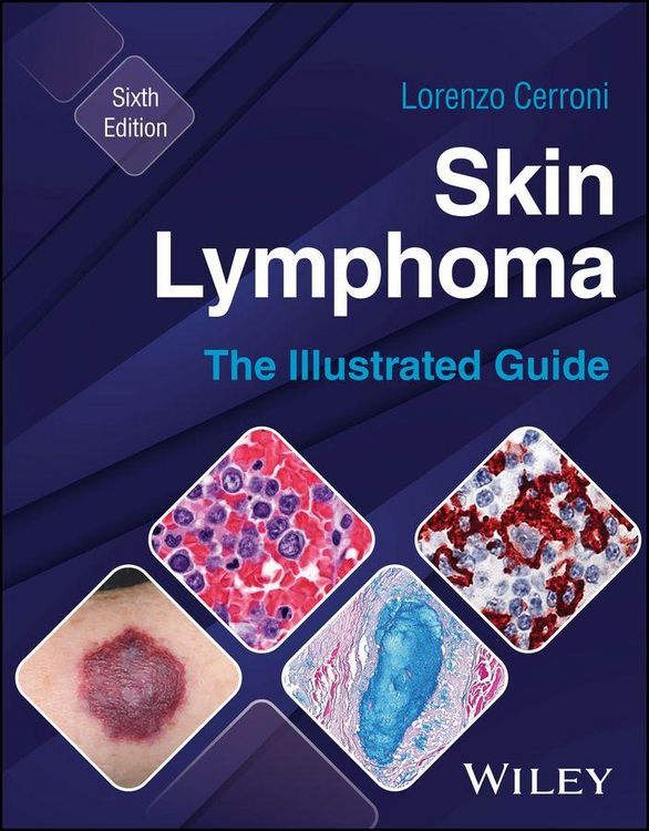 Produktbild: Skin Lymphoma