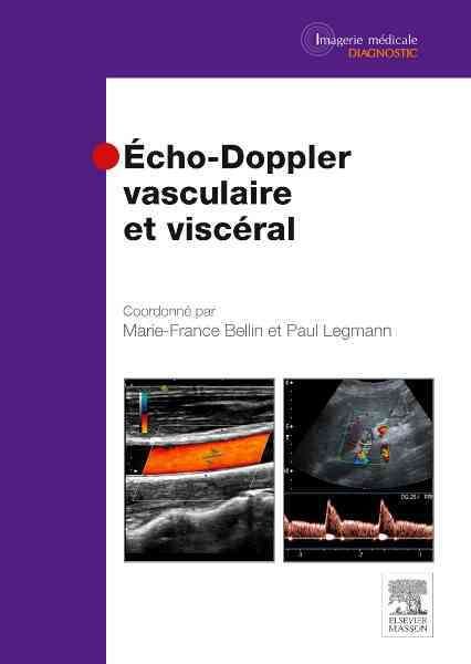 Produktbild: Echo-Doppler vasculaire et visc&eacute;ral
